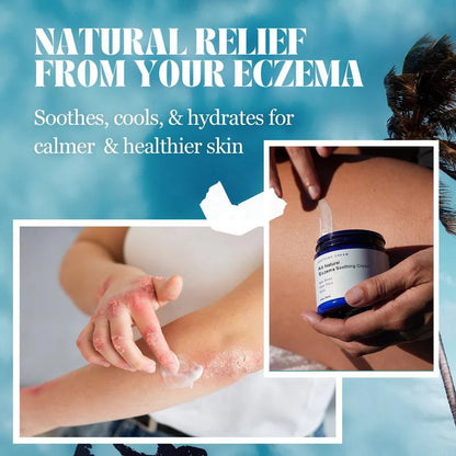 Crema calmante para el eczema totalmente natural The Ocean curó mi eczema