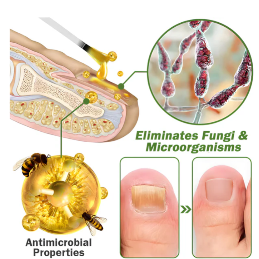 Suero para uñas con veneno de abeja-crecimiento y elimina hongos en 10 dias