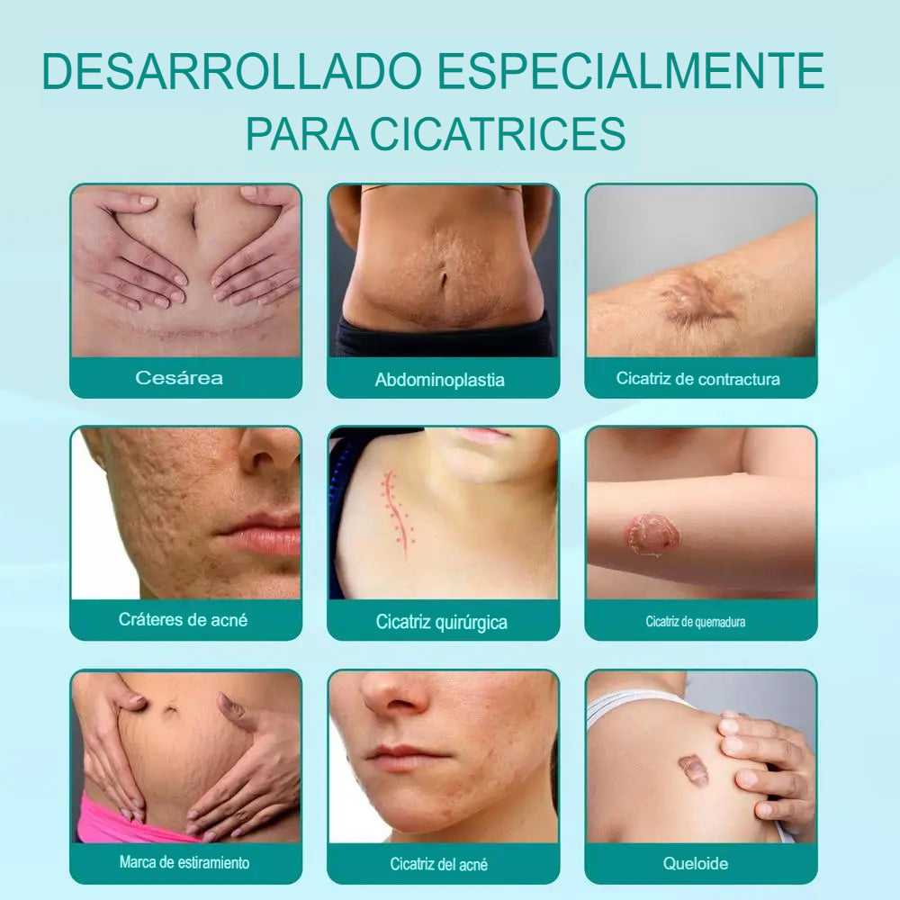 GARANTIZADO!  SCARCLEAR® ELIMINA CICATRICES Y ESTRÍAS PARA SIEMPRE, EN SOLO 7 DÍAS