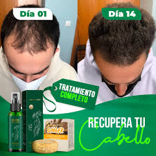 OUHOE-MILAGROSO ELIXIR 🌿 CRECIMIENTO DE CABELLO EN 15 DIAS✅